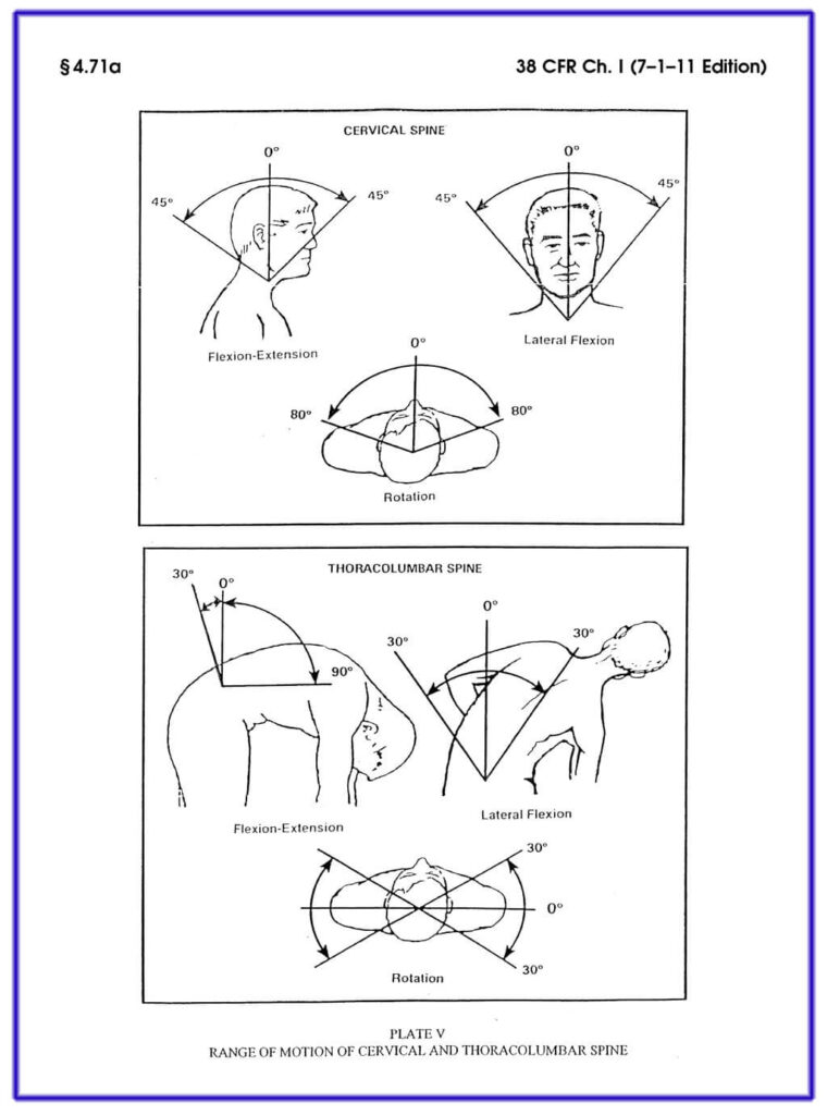 VA Disability for Degenerative Disc Disease and Related Back Pain