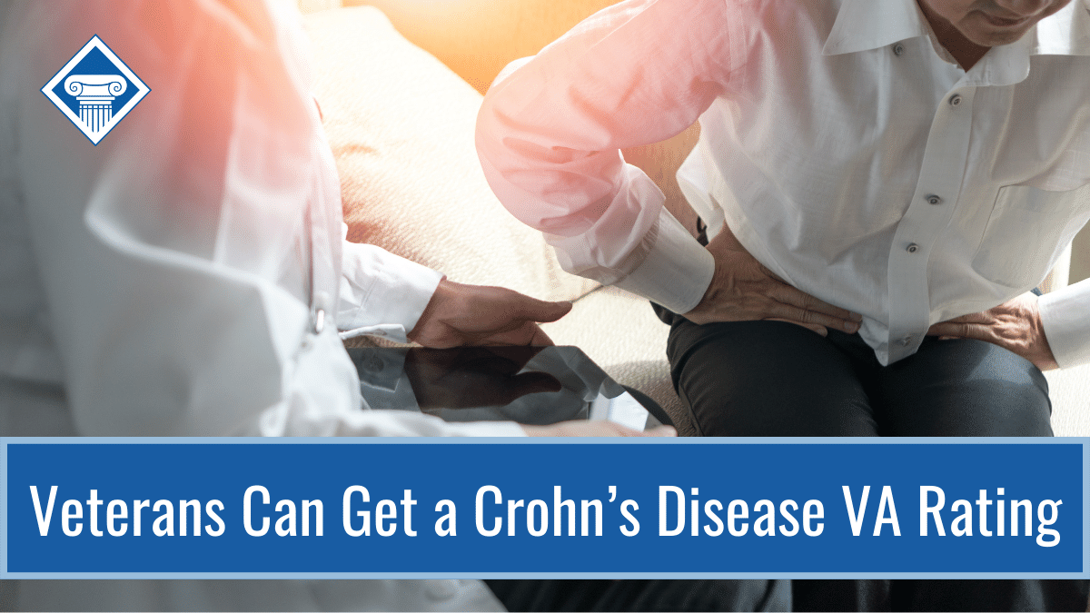 Veterans can get a Crohn's disease VA rating