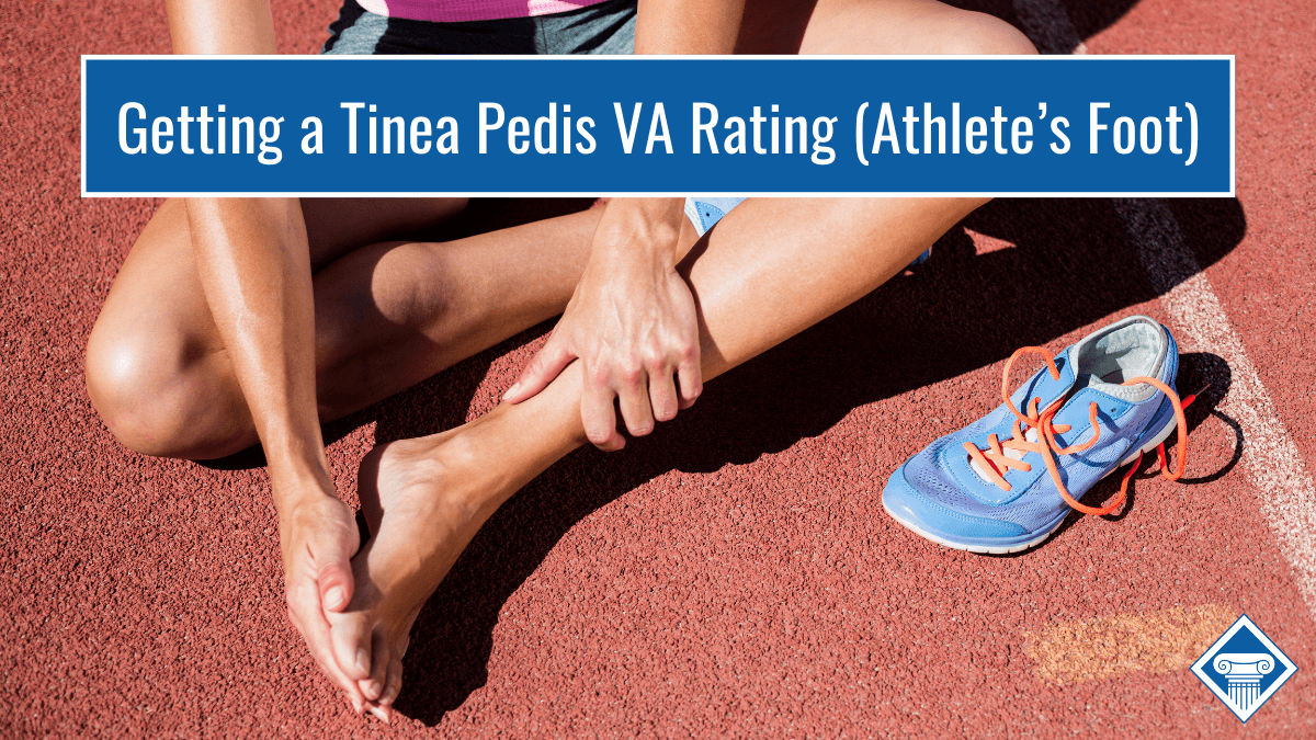 Getting a tinea pedis VA rating (athlete's foot)