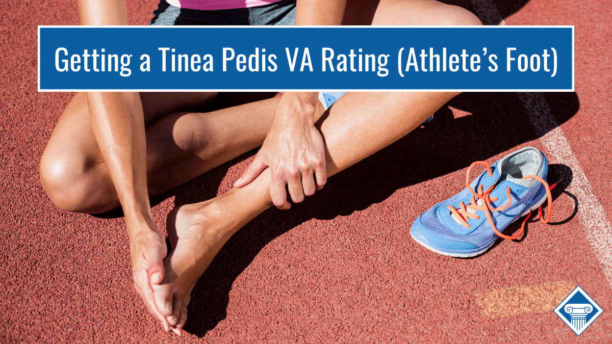 Getting tinea pedis VA benefits (athlete's foot)