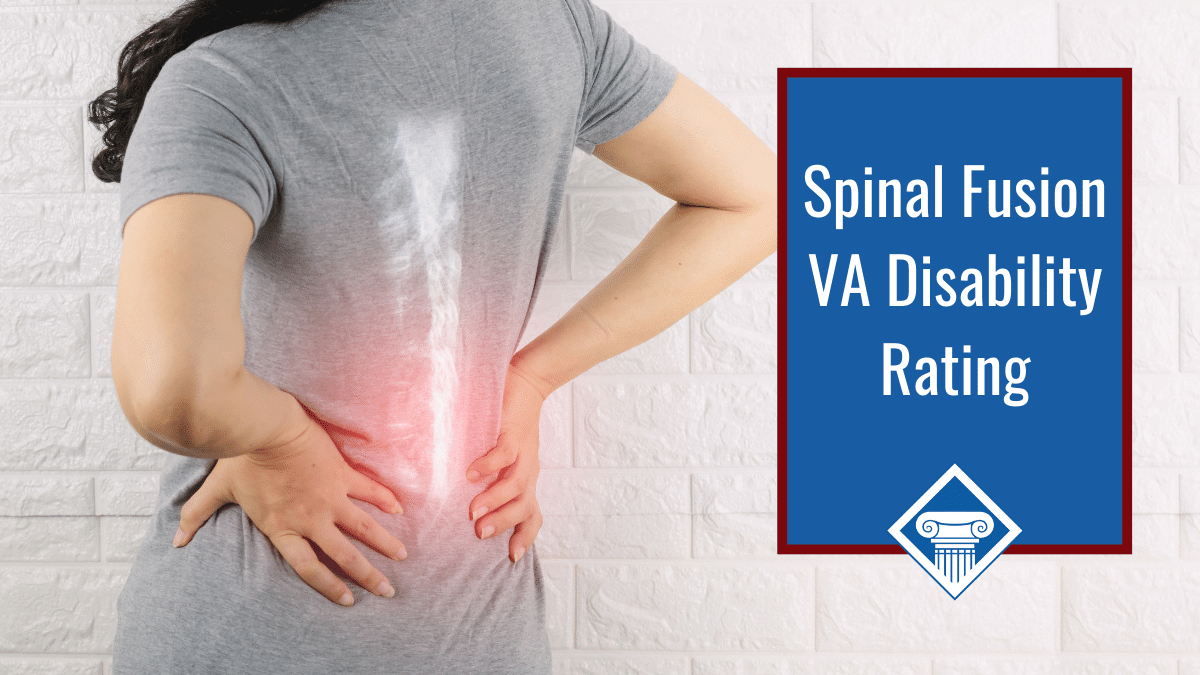 Spinal fusion VA disability rating