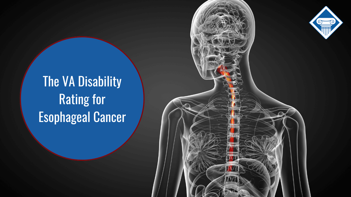 Veterans Disability for Esophageal Cancer Secondary to GERD
