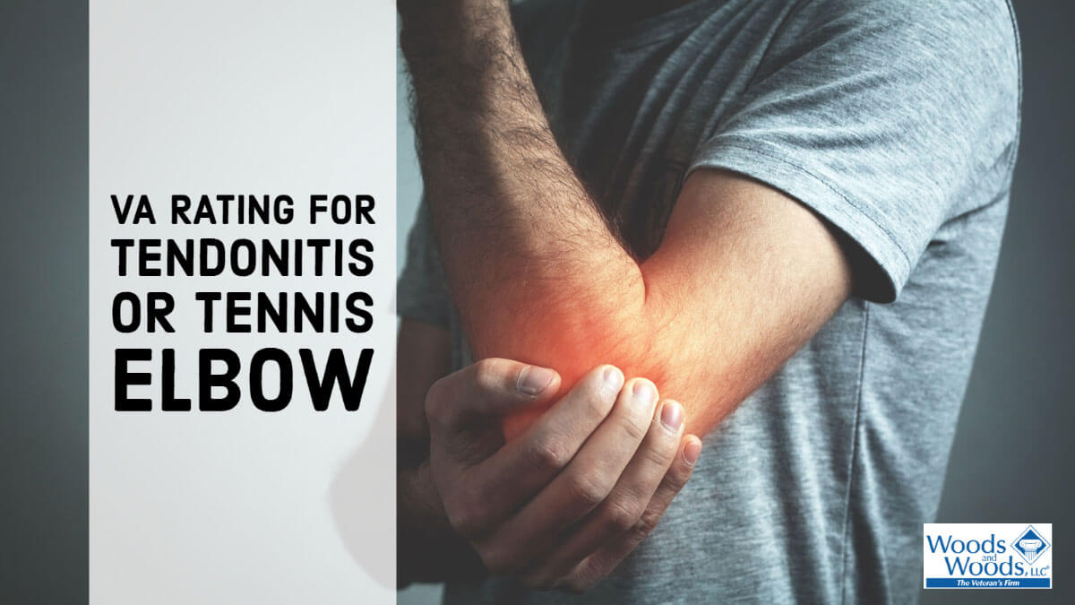 Can veterans get VA benefits for tennis elbow?