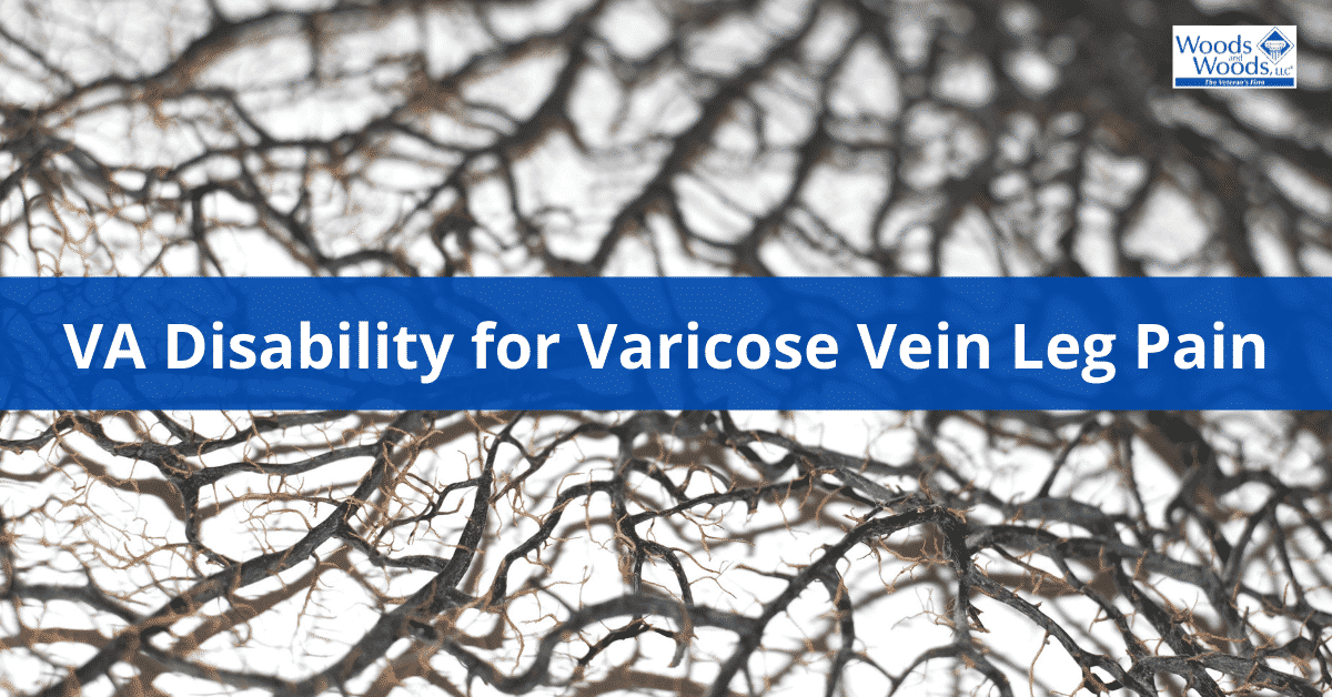 VA Disability for Varicose Vein Leg Pain is Available to Veterans