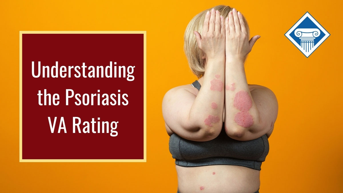 Understanding the psoriasis VA rating
