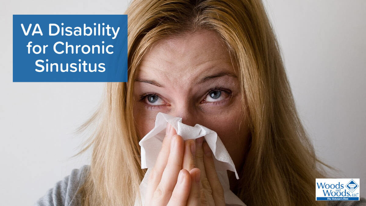 Getting a sinusitis va rating