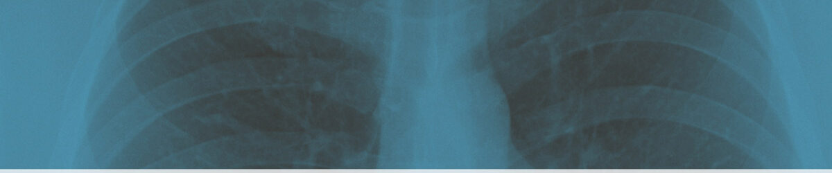 Picture of a lung X-ray with a blue tint to it. Our title appears in front "VA Disability for Lung Nodules."